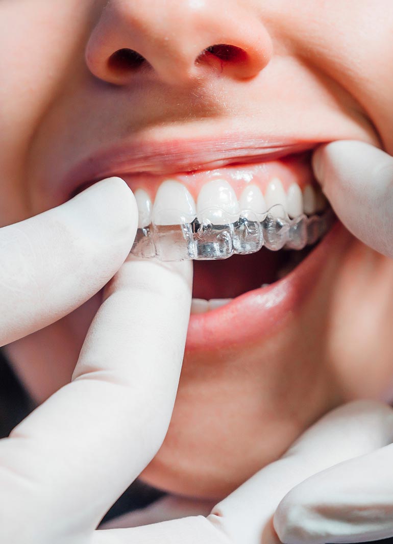 https://www.dentistenapierville.com/wp-content/uploads/2025/07/orthodontie-napierville.jpg